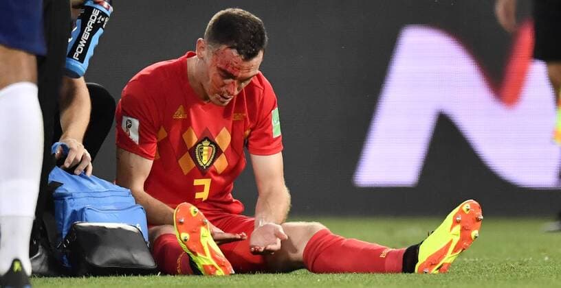 Sport - Bilder des Tages Belgium s Thomas Vermaelen, bleeding after a contact during a soccer game between Belgian national soccer team the Red Devils and England, Thursday 28 June 2018 in Kaliningrad, Russia, the third and last in Group G of the FIFA World Cup WM Weltmeisterschaft Fussball 2018. DIRKxWAEM  x05374077x