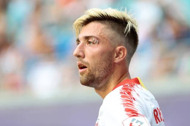 09.08.2018, xtgx, Fussball Europa League 3. Qualirunde, RB Leipzig - CS Universitatea Craiova emspor, v.l. Kevin Kampl (Leipzig, 44) mit verarzteter Platwunde über dem linken Auge, Portrait, Porträt, Einzelbild Leipzig