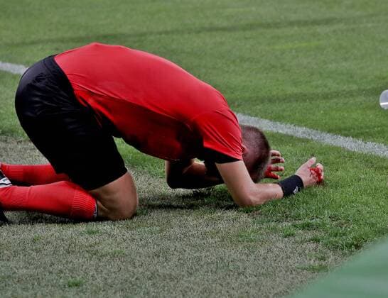 SOCCER - UEFA EL quali, Sturm vs Larnaca GRAZ,AUSTRIA,09.AUG.18 - SOCCER - UEFA Europa League qualification, SK Sturm Graz vs AEK Larnaca. Image shows the injury of assistentreferee Fredrik Klyver. GEPAxpictures xHansxOberlaender