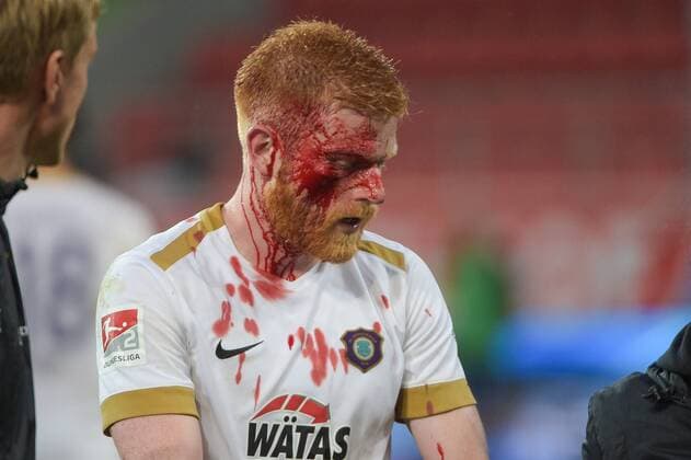 Sport Themen der Woche KW35 Sport Bilder des Tages Verlewtzung bei Fabian Kalig (FC Erzgebirge Aue 4), FC Ingolstadt 04 - FC Erzgebirge Aue, Fussball, 2 Bundesliga, 31.08.2018 DFL REGULATIONS PROHIBIT ANY USE OF PHOTOGRAPHS AS IMAGE SEQUENCES AND OR QUASI-VIDEO Ingolstadt Bayern Deutschland *** Distribution at Fabian Kalig FC Erzgebirge Aue 4 FC Ingolstadt 04 FC Erzgebirge Aue Soccer 2 Bundesliga 31 08 2018 DFL REGULATIONS PROHIBIT ANY USE OF PHOTOGRAPH AS IMAGE SEQUENCES AND OR QUASI VIDEO Ingolstadt Bavaria Germany Copyright: xkolbert-press BurghardxSchreyerx
