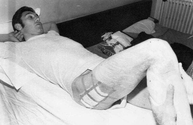 Cyclist Eddy Merckx (L) lies wounded on his hospital bed after a fall in Chamonix (BELGA ARCHIVES)  x85224724stx