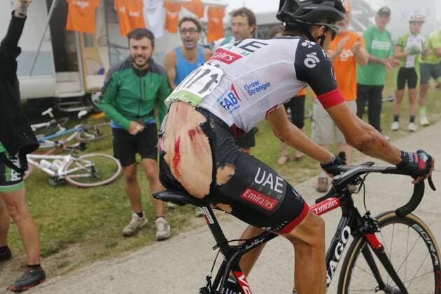 Sport Themen der Woche KW37 Sport Bilder des Tages Italian Fabio Aru of UAE Team Emirates is injured after a fall during the 17th stage of the Vuelta a Espana , Tour of Spain cycling race, 157km from Getxo to Balcon de Bizkaia, Spain, Wednesday 12 September 2018. FRANCE OUT YUZURUxSUNADA  x05424796x