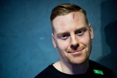 190110 Henrik Jakobsen of Norway with a scar in his forehead during a media event on January 10, 2019 in Herning. Photo: Jon Olav Nesvold BILDBYRN kod JE 160391 Copyright: JONxOLAVxNESVOLD BB190110JE019