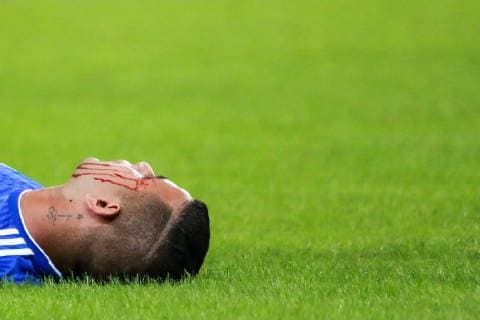 Argentina vs Paraguay BELO HORIZONTE, MG - 19.06.2019: ARGENTINA VS PARAGUAY - Derlis Gonzales of Paraguay suffered a cut in the face during a match between Argentina and Paraguay, valid for the group stage of the Copa America 2019, held this Wednesday (19) at the Estádio do Mineirão in Belo Horizonte, MG. (Photo: Dudu Macedo Fotoarena) x1750291x  DuduxMacedo