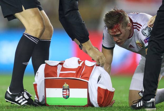 Bilder des Jahres 2019, Sport 10 Oktober Sport Themen der Woche KW41 Sport Bilder des Tages Fußball, EM Quali, Kroatien - Ungarn Adam Lang ozlijedio glavu u kontaktu s RakitiÄ‡em tijekom utakmice Hrvatska - MaÄ‘arska 10.10.2019., stadium Poljud, Split, Croatia - Qualifications for European Championship, EM, Europameisterschaft group E, round 6 , Croatia - Hungary. Adam Lang  IgorxSoban PIXSELL