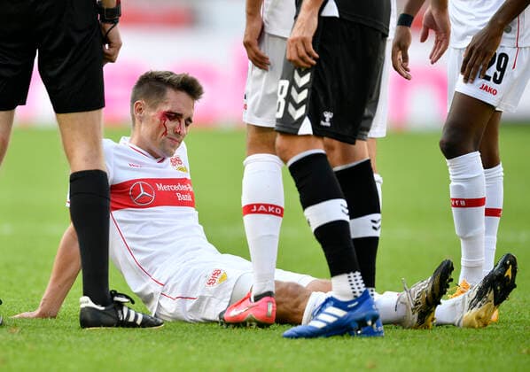 Bilder des Jahres 2020, Sport 09 September Sport Themen der Woche KW38 Philipp Klement VfB Stuttgart verletzt Verletzung butet am Kopf Kopfwunde Blut VfB Stuttgart vs SC Freiburg SCF 19.09.2020 DFL REGULATIONS PROHIBIT ANY USE OF PHOTOGRAPHS AS IMAGE SEQUENCES AND OR QUASI-VIDEO VfB Stuttgart vs SC Freiburg *** Philipp Klement VfB Stuttgart injured Injury Head injury Head wound blood VfB Stuttgart vs SC Freiburg SCF 19 09 2020 DFL REGULATIONS PROHIBIT ANY USE OF PHOTOGRAPHS AS IMAGE SEQUENCES AND OR QUASI VIDEO VfB Stuttgart vs SC Freiburg