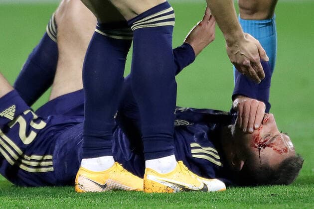 Bilder des Jahres 2020, Sport 12 Dezember Sport Themen der Woche KW50 Sport Bilder des Tages Dinamo Zagreb v CSKA Moskva: Group K - UEFA Europa League Marin Leovac of Dinamo Zagreb lies injured on the pitch during the UEFA Europa League Group K stage match between Dinamo Zagreb and CSKA Moscow at Maksimir Stadium on December 10, 2020 in Zagreb, Croatia. during the UEFA Europa League Group K stage match between Dinamo Zagreb and CSKA Moscow at Maksimir Stadium on December 10, 2020 in Zagreb, Croatia. MarkoxLukunic PIXSELL