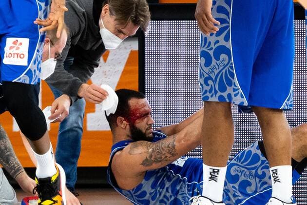 Rasheed Moore (Fraport Skyliners 20) verletzt am Boden GER, Ratiopharm Ulm vs. Fraport Skyliners, easycredit 1.Bundesliga Basketball, 4.Spieltag, Saison 2020 21, 02.02.2021 Ratiopharm Ulm vs. Fraport Skyliners, Basketball Neu-Ulm Copyright: xEibner-Pressefoto RogerxBuerkex EP_EER