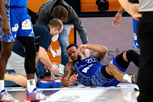 Sport Themen der Woche KW05 Sport Bilder des Tages Rasheed Moore (Fraport Skyliners 20) verletzt am Boden GER, Ratiopharm Ulm vs. Fraport Skyliners, easycredit 1.Bundesliga Basketball, 4.Spieltag, Saison 2020 21, 02.02.2021 Ratiopharm Ulm vs. Fraport Skyliners, Basketball Neu-Ulm Copyright: xEibner-Pressefoto RogerxBuerkex EP_EER