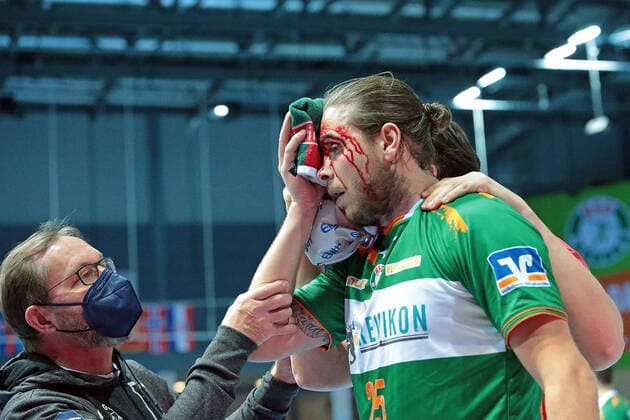 Bilder des Jahres 2021, Sport 02 Februar Sport Themen der Woche KW07 Sport Bilder des Tages 18.02.2021, xovx, Handball 1. Bundesliga, HSG Wetzlar - TSV Hannover-Burgdorf v.l. Olle Forsell Schefvert (HSG Wetzlar) schwer verletzt im Gesicht emspor Wetzlar *** 18 02 2021, xovx, Handball 1 Bundesliga, HSG Wetzlar TSV Hannover Burgdorf v l Olle Forsell Schefvert HSG Wetzlar badly injured in the face emspor Wetzlar