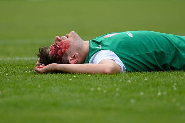 Pascal Henninger (Schweinfurt, 4) liegt mit Platzwunde benommen auf dem Rasen, mit Schmerzen nach einem Foul, racked with pain Einzelbild, Aktion, Action, 6 20 2021, Unterhaching (Deutschland), Fussball, Relegation zur A-Junioren-Bundesliga, SpVgg Unterhaching U19 - 1. FC Schweinfurt 05 U19