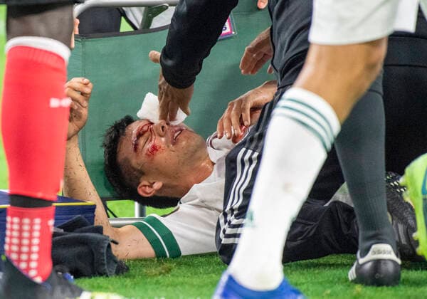 Jul 10, 2021: Mexico forward Hirving Lozano (22) lays on the field after receiving a laceration above his left eye in the first half during a CONCACAF Gold Cup game between Mexico and Trinidad & Tobago at AT&T Stadium in Arlington, TX Mexico and Trinidad & Tobago tied 0-0 CSM Arlington USA - ZUMAcp2_ 20210710_zaf_cp2_005 Copyright: xAlbertxPenax