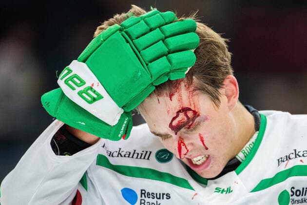 Sport Themen der Woche KW41 211014 Rögles Samuel Johannesson blöder efter en tackling under ishockeymatchen i SHL mellan Frölunda och Rögle den 14 oktober 2021 i Göteborg . *** 211014 Rögles Samuel Johannesson bleeds after a tackle during the ice hockey match in the SHL between Frölunda and Rögle on October 14, 2021 in Gothenburg,  Copyright: MICHAELxERICHSEN BB211014MI011