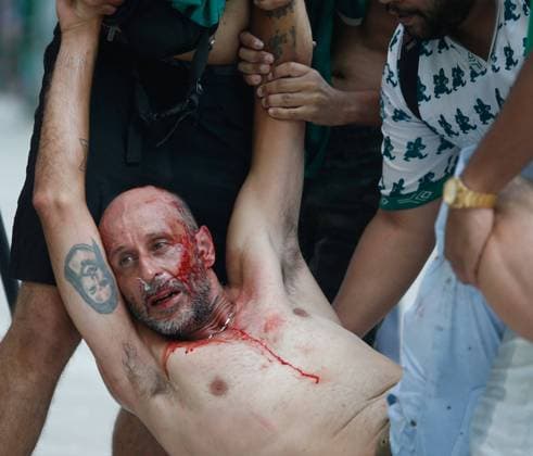 Fan injured as supporters of Palmeiras gather outside the stadium to watch the Final of the Club World Cup 2021 that was ultimately won by Chelsea 2-1 after extra time FERNANDO ROBERTO SPP Chelsea v Palmeiras Fans in Sao Paulo 
