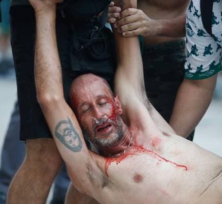 Fan injured as supporters of Palmeiras gather outside the stadium to watch the Final of the Club World Cup 2021 that was ultimately won by Chelsea 2-1 after extra time FERNANDO ROBERTO SPP Chelsea v Palmeiras Fans in Sao Paulo 