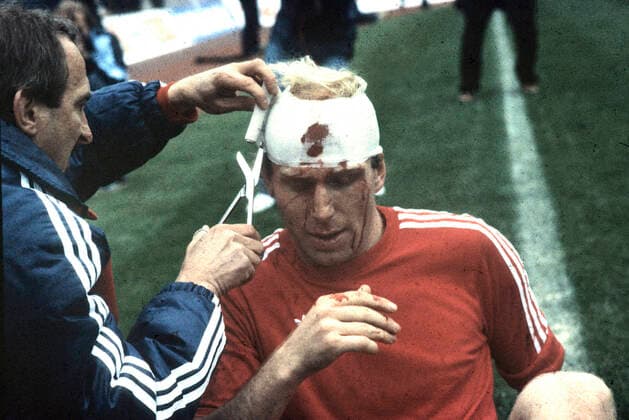 DFB Pokalendspiel FC Bayern Muenchen - 1. FC Nuernberg 4:2 01.05.1982 Dieter Hoeneß (FCB) am Kopf verletzt bekommt Kopfverband angelegt *** DFB Pokalendspiel FC Bayern Muenchen 1 FC Nuernberg 4 2 01 05 1982 Dieter Hoeneß FCB injured head gets head bandage applied HM