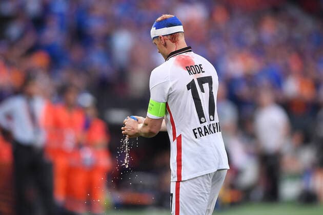 Sport Bilder des Tages Fußball Europa League Finale Eintracht Frankfurt - Glasgow Rangers am 18.05.2022 im Estadio Ramon Sanchez-Pizjuan in Sevilla Sebastian Rode ( Frankfurt ) am Kopf verletzt