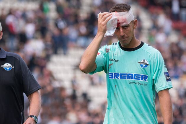 Sport Themen der Woche KW34 Sport Bilder des Tages Fußball, Saison 2022 23, 2. Bundesliga, FC St. Pauli - SC Paderborn 07, Millerntor-Stadion (Hamburg), 27.08.2022, 6. Spieltag Uwe Hünemeier ( 2, Paderborn) mit blutigem Kopfverband und Kühlbeutel (Nur zur redaktionellen Nutzung.) Hamburg Millerntor-Stadion, Heiligengeistfeld, Harald-Stender-Platz 1 Hamburg Deutschland *** Soccer, season 2022 23, 2 Bundesliga, FC St Pauli SC Paderborn 07, Millerntor Stadion Hamburg , 27 08 2022, 6 matchday Uwe Hünemeier 2, Paderborn with bloody head bandage and cooling bag For editorial use only Hamburg Millerntor Stadion, Heiligengeistfeld, Harald Stender Platz 1 Hamburg Germany Copyright: xIMAGO. Lobeca RobertoxSeidel,xAllxrightsxnotxspecificallyxgrantedxarexreserved.x