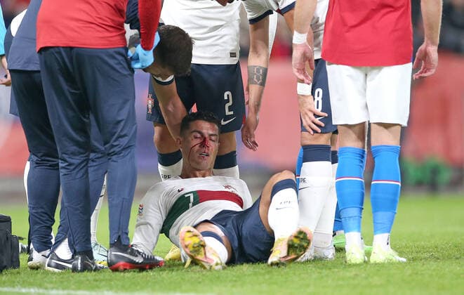 Bilder des Jahres 2022, Sport 09 September Sport Themen der Woche KW38 Sport Bilder des Tages Fußball, Nations League, Tschechien - Portugal, Cristiano Ronaldo blutet nach Zusammenprall 24.09.2022, Fussball Länderspiel UEFA Nations League 2022 23, Tschechische Republik - Portugal, in der Fortuna Arena Prag. Cristiano Ronaldo (Portugal) verletzt nach Zusammenprall und muss behandelt werden *** 24 09 2022, football international match UEFA Nations League 2022 23, Czech Republic Portugal, at Fortuna Arena Prague Cristiano Ronaldo Portugal injured after collision and requires treatment