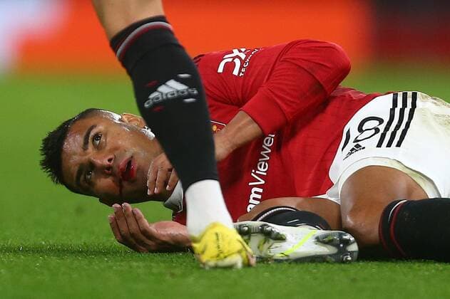 Sport Bilder des Tages Mandatory Credit: Photo by Phil Oldham Shutterstock (13491515o) Casemiro of Manchester United, ManU with a bloodied mouth Manchester United v Sheriff Tiraspol, UEFA Europa League, Group E, Football, Old Trafford, Manchester, UK - 27 Oct 2022 EDITORIAL USE ONLY No use with unauthorised audio, video, data, fixture lists, club league logos or live services. Online in-match use limited to 120 images, no video emulation. No use in betting, games or single club league player publications. Manchester United v Sheriff Tiraspol, UEFA Europa League, Group E, Football, Old Trafford, Manchester, UK - 27 Oct 2022 EDITORIAL USE ONLY No use with unauthorised audio, video, data, fixture lists, club league logos or live services. Online in-match use limited to 120 images, no video emulation. No use in betting, games or single club league player publications. Copyright: xPhilxOldham Shutterstockx 13491515o
