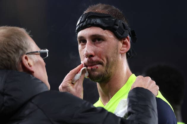 Arsenal v FC Zurich 03 November 2022, London - UEFA Europa League Group Stage - Arsenal v FC Zurich - Nikola Katic of Zurich has blood cleared from his face. - Photo: Jacques Feeney Offside. London UK Copyright: xJacquesxFeeneyx xOffsidexOffside