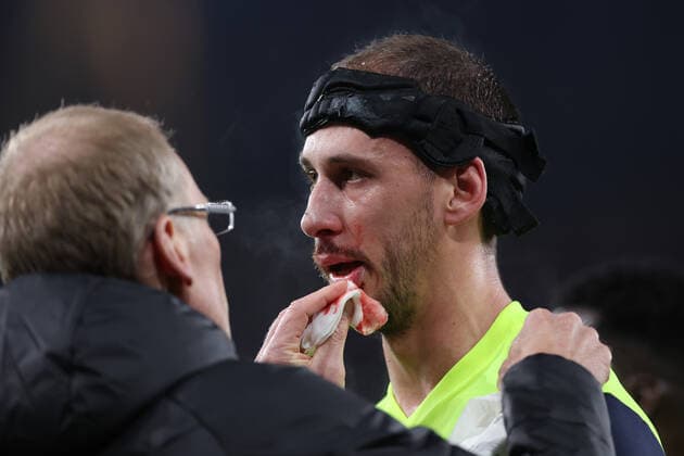 Arsenal v FC Zurich 03 November 2022, London - UEFA Europa League Group Stage - Arsenal v FC Zurich - Nikola Katic of Zurich has blood cleared from his face. - Photo: Jacques Feeney Offside. London UK Copyright: xJacquesxFeeneyx xOffsidexOffside