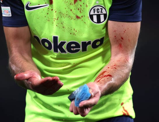 Sport Themen der Woche KW44 Sport Bilder des Tages Arsenal v FC Zurich 03 November 2022, London - UEFA Europa League Group Stage - Arsenal v FC Zurich - Nikola Katic of Zurich attempts to clean blood from his arms - Photo: Jacques Feeney Offside. London UK *** Arsenal gegen FC Zürich 03. November 2022, London UEFA Europa League Gruppenphase Arsenal gegen FC Zürich Nikola Katic von Zürich versucht, sich das Blut von den Armen zu waschen Foto Jacques Feeney Offside London UK  Copyright: xJacquesxFeeneyx xOffsidexOffside
