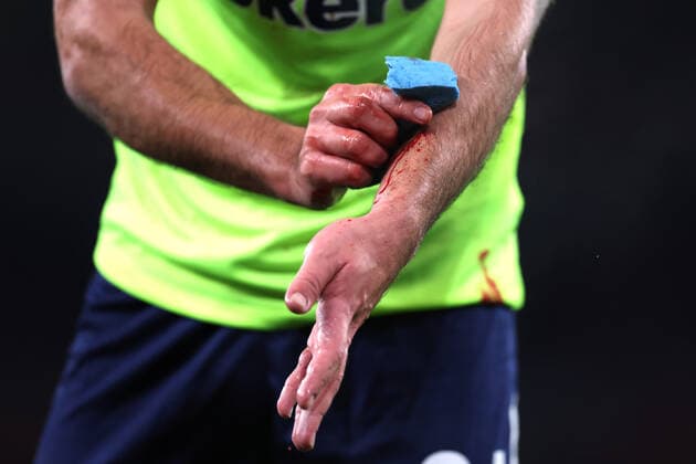 Arsenal v FC Zurich 03 November 2022, London - UEFA Europa League Group Stage - Arsenal v FC Zurich - Nikola Katic of Zurich attempts to clean blood from his arms - Photo: Jacques Feeney Offside. London UK Copyright: xJacquesxFeeneyx xOffsidexOffside