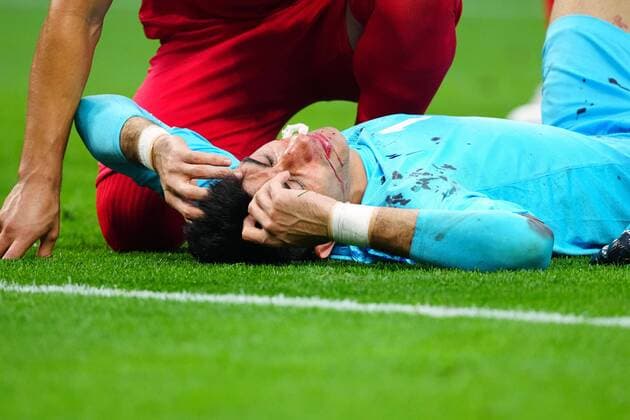 Sport Themen der Woche KW47 Sport Bilder des Tages Mandatory Credit: Photo by Javier Garcia Shutterstock (13626340bm) Alireza Beiranvand of Iran receives treatment for a bloodied nose England v Iran, FIFA World Cup, WM, Weltmeisterschaft, Fussball 2022, Group B, Football, Khalifa International Stadium, Ar-Rayyan, Qatar - 21 Nov 2022 Editorial Use Only England v Iran, FIFA World Cup 2022, Group B, Football, Khalifa International Stadium, Ar-Rayyan, Qatar - 21 Nov 2022 Editorial Use Only  Copyright: xJavierxGarcia Shutterstockx 13626340bm