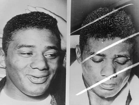 BOXING CHAMPION FLOYD PATTERSON FACES 11 MARCH 1961  Copyright: xTopFotox IPU410403