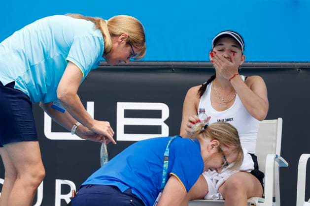 Eva Lys wird am Handgelenk wegen einer Verletzung behandelt,nimmt eine Tablette, Physiotherapeut, Doktor, Australian Open 2023, Melbourne Park, Melbourne, Victoria, Australia. Copyright: xJuergenxHasenkopfx