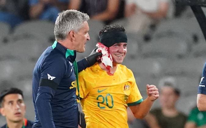 Sport Themen der Woche KW13 Sport Bilder des Tages SOCCER AUSTRALIA ECUADOR, Cameron Devlin of the Socceroos leaves the field injured during the soccer match between the Australian Socceroos and Ecuador, as part of the Socceroos Welcome Home Series, at Marvel Stadium in Melbourne, Tuesday, March 28, 2023. ( NO ARCHIVING, EDITORIAL USE ONLY, NO USE IN BOOKS WITHOUT CONSENT MELBOURNE VICTORIA AUSTRALIA  Copyright: xSCOTTxBARBOURx 20230328001780190996