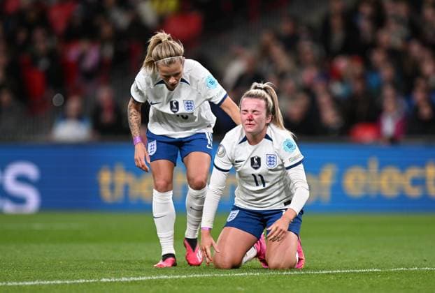 IMAGO Iconic Moments, Fußball - Frauen England Women v Brazil CONMEBOL UEFA Women s Champions Cup Finalissima Lauren Hemp of England down with an injury with blood coming from her nose uring the CONMEBOL UEFA Women s Champions Cup Finalissima match between England Women and Brazil at Wembley Stadium, London, England on 6 April 2023. London Wembley Stadium Greater London England Editorial use only , Copyright: xGrahamxHuntx PSI-17188-0071