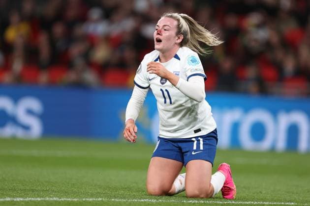 UEFA Women™s Finalissima 06 April 2023, Wembley - UEFA Women™s Finalissima - England v Brazil Women - Lauren Hemp of England sustains a cut nose - Photo: Charlotte Wilson Offside. London UK Copyright: xCharlottexWilsonx xOffsidexOffside