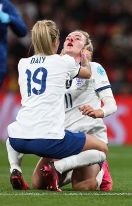 UEFA Women™s Finalissima 06 April 2023, Wembley - UEFA Women™s Finalissima - England v Brazil Women - Rachel Daly checks on Lauren Hemp of England who had sustained a cut nose. Photo: Charlotte Wilson Offside. London UK Copyright: xCharlottexWilsonx xOffsidexOffside