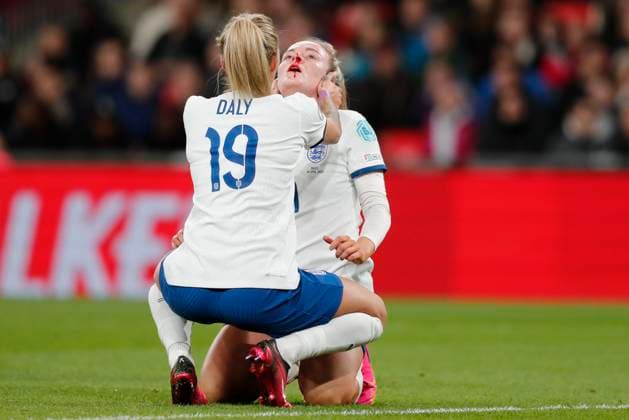 England Women v Brazil Women Womens Finalissima 2023 Lauren Hemp of England gets a bloody nose during the Womens Finalissima 2023 match between England Women and Brazil Women at Wembley Stadium, London Content Not Available For UK Newspapers Copyright: xPaulxChestertonx FIL-18329-0078 UK Newspapers OUT