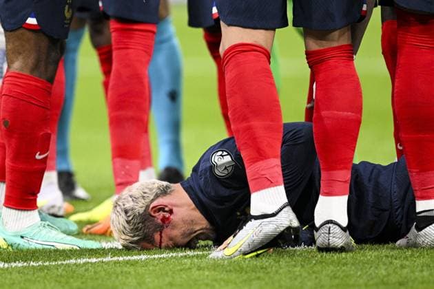 Sport Bilder des Tages Blessure de GRIEZMANN Antoine (FRA) a la tete FOOTBALL : France vs Grece - Qualifications Euro2024 - 19 06 2023 JBAutissier Panoramic  
