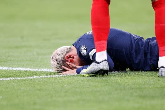 Frankreich, Paris, 19.06.2023 UEFA EURO, EM, Europameisterschaft,Fussball 2024 Qualifiers Group B Frankreich - Griechenland v.l., Antoine Griezmann (FFF Frankreich) verletzt sich am Kopf, Blut läuft aus Copyright: AntonioxBorga