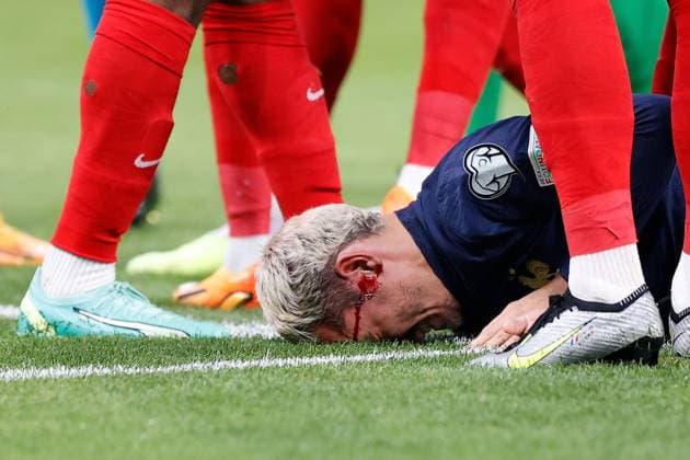 Sport Bilder des Tages Frankreich, Paris, 19.06.2023 UEFA EURO, EM, Europameisterschaft,Fussball 2024 Qualifiers Group B Frankreich - Griechenland v.l., Antoine Griezmann (FFF Frankreich) verletzt sich am Kopf, Blut läuft aus Copyright: AntonioxBorga