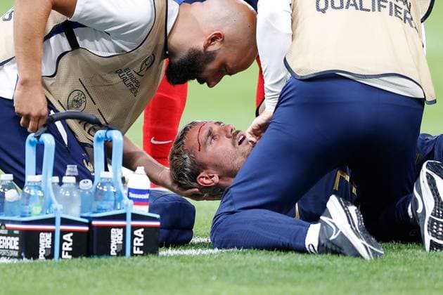 Frankreich, Paris, 19.06.2023 UEFA EURO, EM, Europameisterschaft,Fussball 2024 Qualifiers Group B Frankreich - Griechenland v.l., Antoine Griezmann (FFF Frankreich) verletzt sich am Kopf, Blut läuft aus Copyright: AntonioxBorga