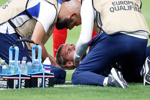 Frankreich, Paris, 19.06.2023 UEFA EURO, EM, Europameisterschaft,Fussball 2024 Qualifiers Group B Frankreich - Griechenland v.l., Antoine Griezmann (FFF Frankreich) verletzt sich am Kopf, Blut läuft aus Copyright: AntonioxBorga
