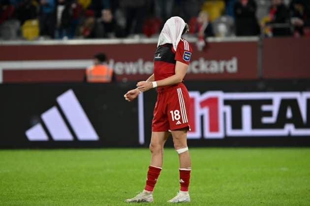 Jona Niemiec unzufrieden enttäuscht enttaeuscht niedergeschlagen frustriert, 03.11.2023 Fussball Fortuna Duesseldorf vs SV Wehen Wiesbaden, Merkur Spiel-Arena, Duesseldorf, DFB DFL REGULATIONS PROHIBIT ANY USE OF PHOTOGRAPHS AS IMAGE SEQUENCES AND OR QUASI-VIDEO NRW Germany