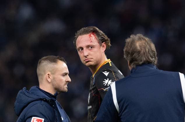 Fussball, Herren, Saison 2023 2024, 2. Bundesliga (13. Spieltag), Hertha BSC - Karlsruher SC, Robin Bormuth (Karlsruher SC) mit blutender Wunde am Kopf 11.11. 2023,