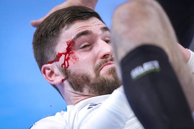 Handball, EM 2024 in Deutschland, Die Highlights 22.01.2024, EHF EURO 2024, Männer Europameisterschaft Handball, Lanxess Arena in Köln, Frankreich - Österreich: Schockmoment in der zweiten Halbzeit - Ludovic Fabregas (Frankreich) liegt mit blutigem Gesicht auf dem Boden. Blut strömt aus einer Verletzung im Gesicht. Nordrhein-Westfalen Deutschland