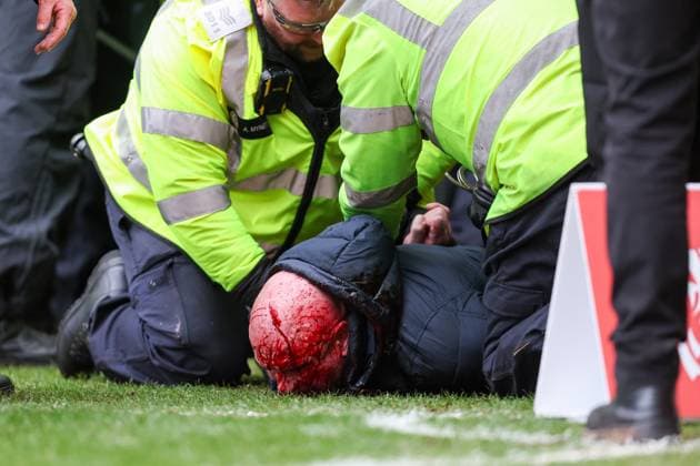 Sport Themen der Woche KW04 Sport Bilder des Tages Sport Bilder des Tages A bleeding supporter is restrained following an incident during the Emirates FA Cup 4th Round match between West Bromwich Albion and Wolverhampton Wanderers at The Hawthorns, West Bromwich, England on 28 January 2024. Copyright: xStuartxLeggettx 39540042