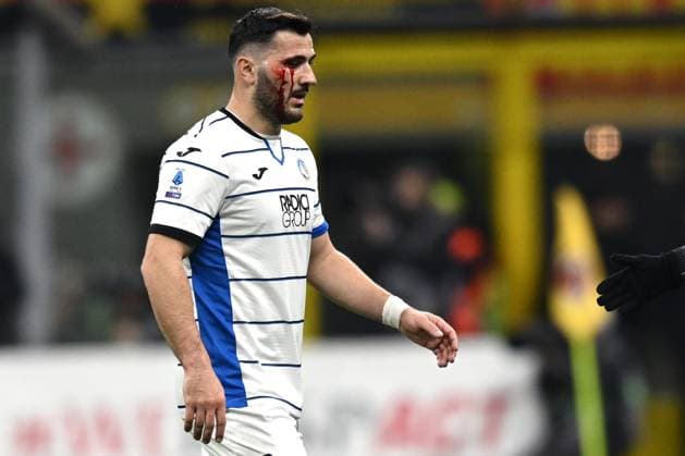 Sport Themen der Woche KW08 Sport Bilder des Tages Db Milano 25 02 2024 - campionato di calcio serie A Milan-Atalanta foto Daniele Buffa Image nella foto: Sead Kolasinac 