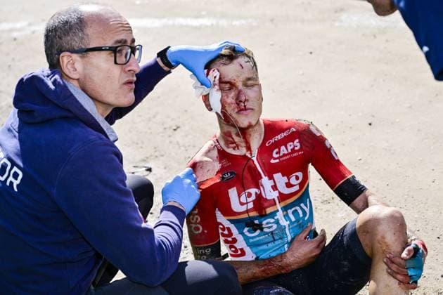 Bilder des Jahres 2024, Sport 03 März Sport Themen der Woche KW09 Belgian Arjen Livyns of Lotto Dstny lies injured on the ground during the men s elite race of the Strade Bianche one day cycling race (215km) from and to Siena, Italy, Saturday 02 March 2024. DIRKxWAEM  x87846314x