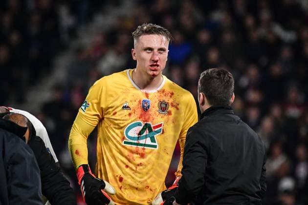 Bilder des Jahres 2024, Sport 03 März Sport Themen der Woche KW11 Sport Bilder des Tages French Cup - PSG v Nice OGC Nice?s goalkeeper Marcin Bulka bleeds during the French Cup football match between Paris Saint-Germain and OGC Nice at the Parc des Princes stadium in Paris, France on March 13, 2024. Photo by Firas Abdullah ABACAPRESS.COM Paris France  Copyright: xAbdullahxFiras ABACAx