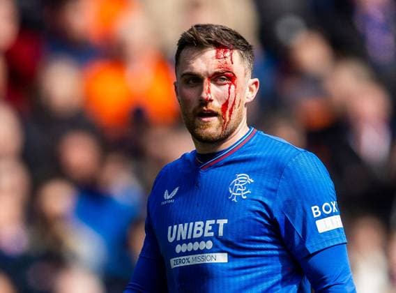 Sport Themen der Woche KW14 Sport Bilder des Tages Rangers Defender John Souttar with a bloody face during today s Old Firm match at Ibrox. Rangers v Celtic, Cinch Scottish Premiership, Football, Ibrox Stadium, Glasgow, UK - 07 Apr 2024  Copyright: xLukexNickerson RangersxFC Shutterstockx 14422874ay
