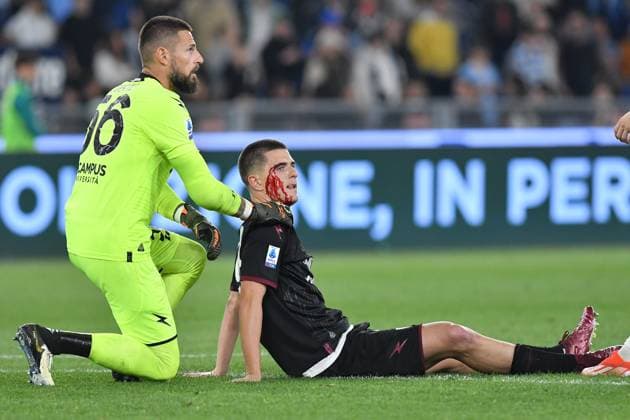 Sport Themen der Woche KW15 Sport Bilder des Tages Italy,Soccer, Serie A match , Lazio v Salernitana Lorenzo Pirola of Salernitana blooding during the Serie A match between Lazio v Salernitana at Olympic stadium, Italy, April 12nd, 2024. Imago-Images Emmefoto Copyright: xImago-Images Emmefotox